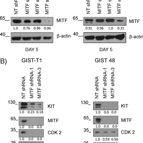 MITF Silencing Reduces KIT BCL2 And CDK2 Expression A MITF Expression