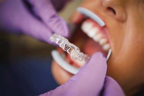 Qual Faculdade Fazer Tratamento Dentário Gratuito - 8