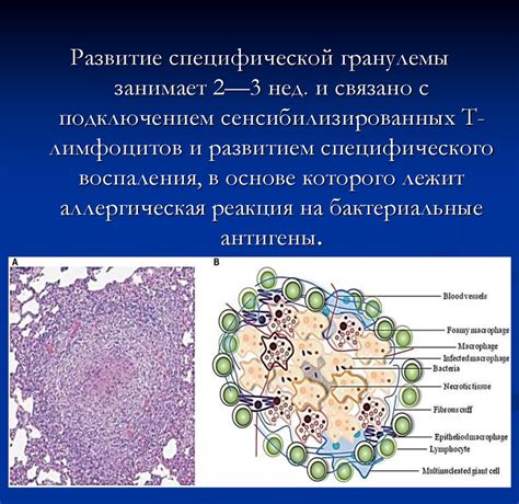 Патогенные микобактерии - online presentation