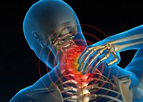 Cervicalgia Suas Causas E Tratamentos Santibras