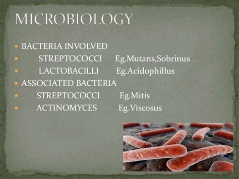 Microbiology Of Dental Caries