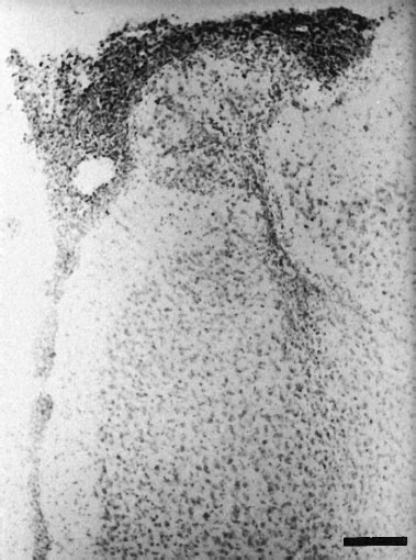 Photomicrograph Of A Coronal Section Of Mpfc Stained With Cresyl Violet