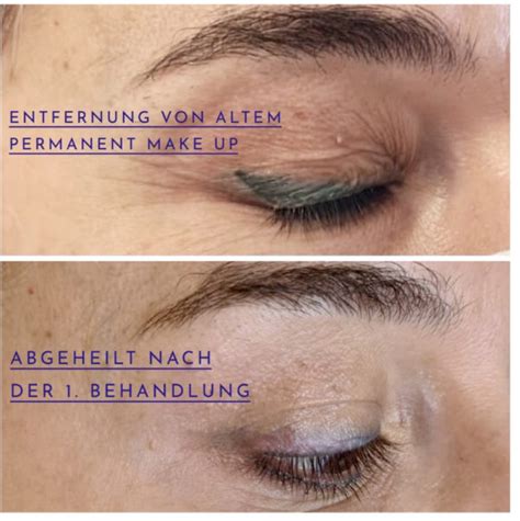 Permanent Make Up Entfernung Permanent Make Up M Nchen Preise Bei