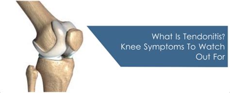 What Is Tendonitis? Knee Symptoms To Watch Out For - Health In Motion