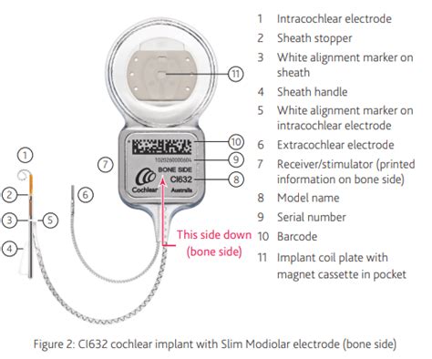 MRI Compatible Cochlear Implant - Good Design