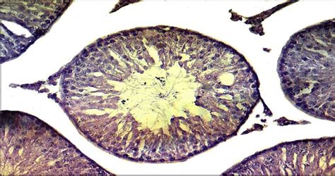 Photomicrograph Of Testis Section From Control Group Showing Closely