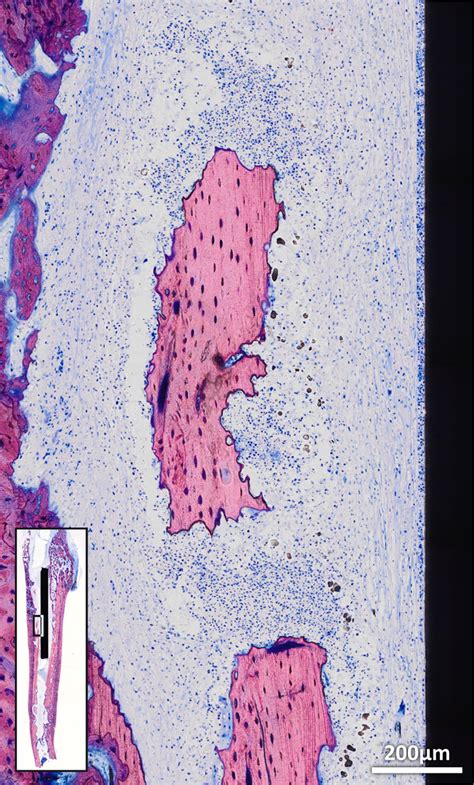 Histological Characteristics Shown Are Numerous Intramedullary Download Scientific Diagram