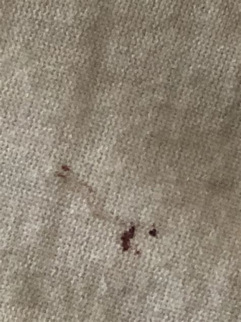 Found These Stains On My Pillow For The Second Time This Month Could