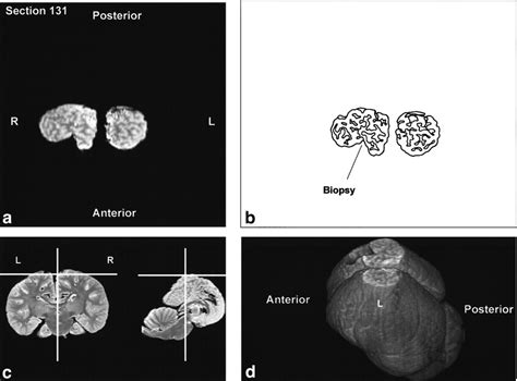 Anatomy And Three‐dimensional Reconstructions Of The Brain Of A