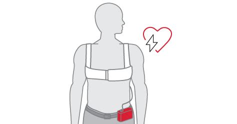 Types of Defibrillators - Heart Saver NZ