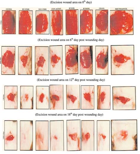 Photographic plates were showing various stages of wound closure of ...