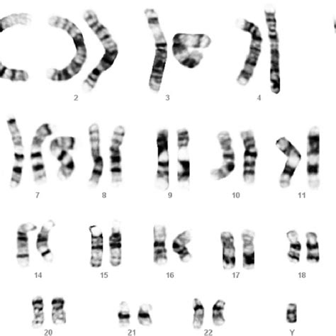 Oligonucleotide Based Array Comparative Genomic Hybridization Acgh