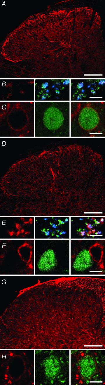 Morphological Neurochemical And Electrophysiological Features Of