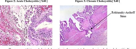 Gallbladder Histology Labeled