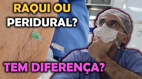 Qual A Diferen A Entre A Raquianestesia E A Anestesia Peridural Youtube