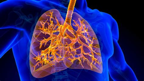 Understanding Interstitial Lung Disease: A Comprehensive Guide - Namdrc