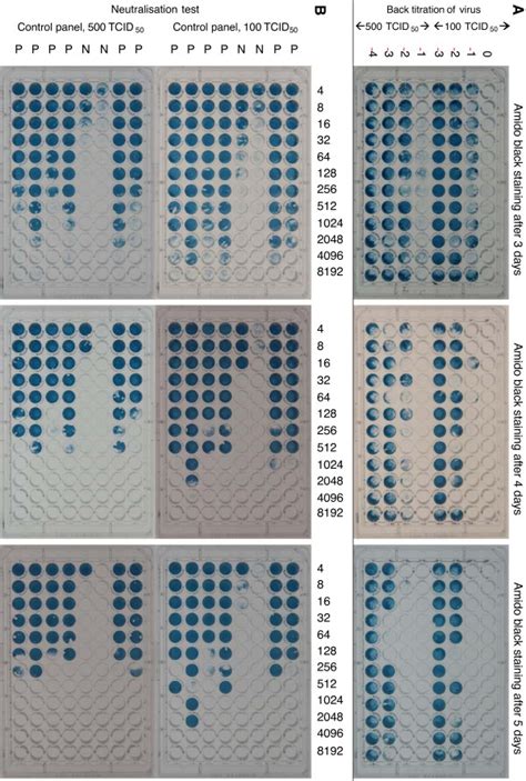 Amido Black Staining Of Control Plates For Comparison Of 100 Vs 500 Download Scientific