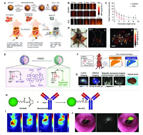 Nir Ii Based Tumor Delineation And Image Guided Surgery A