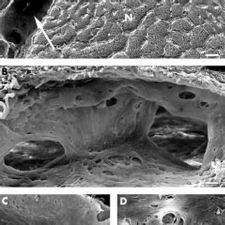 TEM morphology of arachnoid trabeculae in the bulbar segment. The... | Download Scientific Diagram