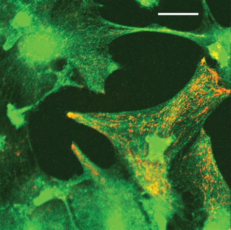 Mitochondria Targeted Antioxidant Skqr A Red Colored Fluorescent Skq