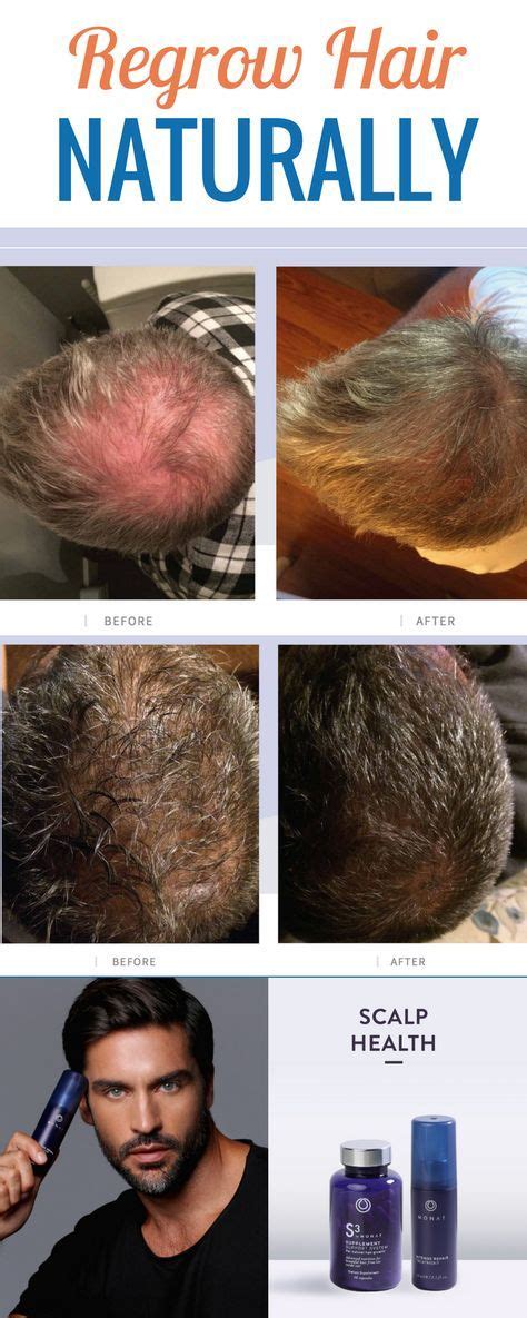 How Do These Men Regrow Hair And Get Natural Results Without Harsh Chemicals To Get Results