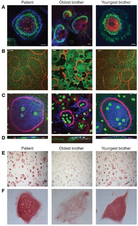 Figure 4 From Involvement Of PLEKHM1 In Osteoclastic Vesicular