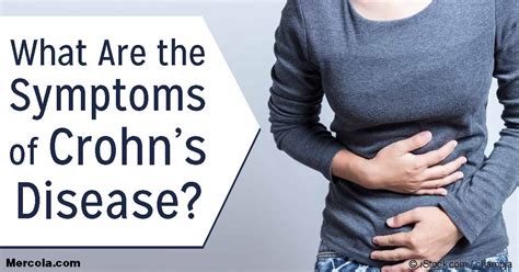 What Are the Symptoms of Crohn’s Disease?