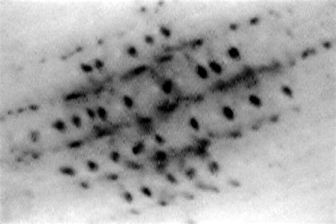 The Parallel Furrow Pattern Accompanied By Dots Globules Regularly Download Scientific Diagram