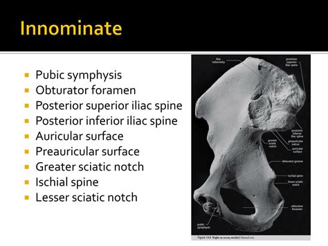 Ppt The Pelvic Girdle Powerpoint Presentation Free Download Id2199308