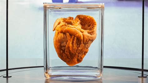 Heart transplant | IFLScience