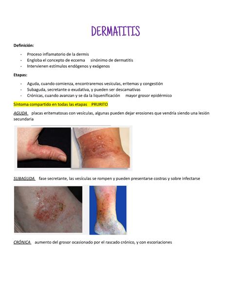 Dermatitis Dermatología Dermatitis Definición Proceso Inflamatorio De La Dermis Engloba El