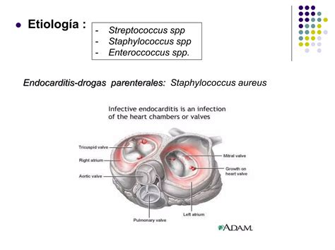 Tema Bacteriemia Y Endocarditis Infecciosa Ppt