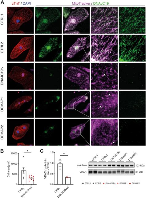 Mutations In DNAJC19 Cause Altered Mitochondrial Structure And