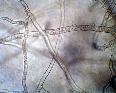 Fungal Classification Lower And Higher Fungi Plantlet