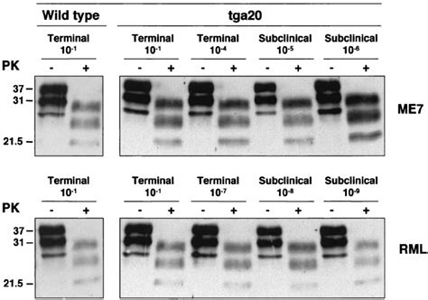 Western Blot Analysis Of Prp Sc In Brain Stem Homogenates From Me Or