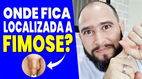 Descubra ONDE SE LOCALIZA A FIMOSE E Aprenda O Que Fazer Para Tirar A