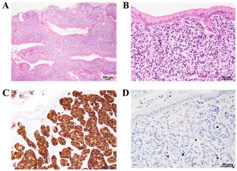 Hematoxylin And Eosin Staining A Sub Epithelial And Sub Mucosal