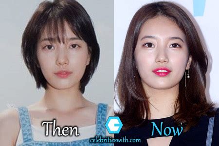 Bae Suzy Plastic Surgery: Eyelid-Nose Surgery Rumors, Before After Pics ...