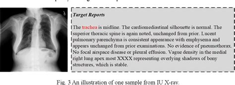 Figure 4 From Dynamic Multi Domain Knowledge Networks For Chest X Ray