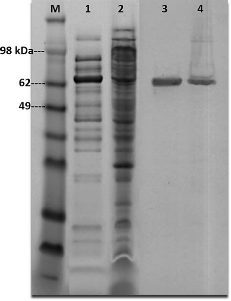 Sds Page And Western Blot Of Soluble And Insoluble Extracts From E