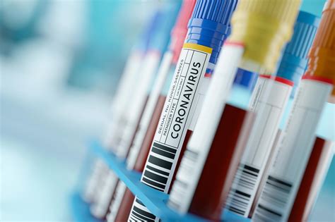 New Blood Test Accurately Predicts Which Covid Patients Will Develop