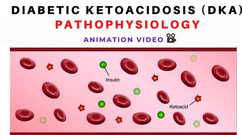 Pathophysiology Of Diabetic Ketoacidosis DKA Animation YouTube