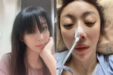 《戲說台灣》女星驚傳腸爆裂病危