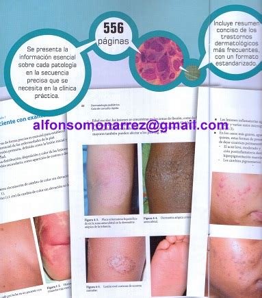 Libros Dermatolog A Pedi Trica Gu A De Consulta R Pida Dermatitis Acn