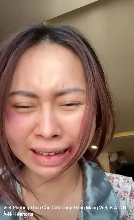 TikToker Việt Phương Thoa cầu cứu vì bị bạn trai tác động bầm tím mặt CĐM phẫn nộ Hot