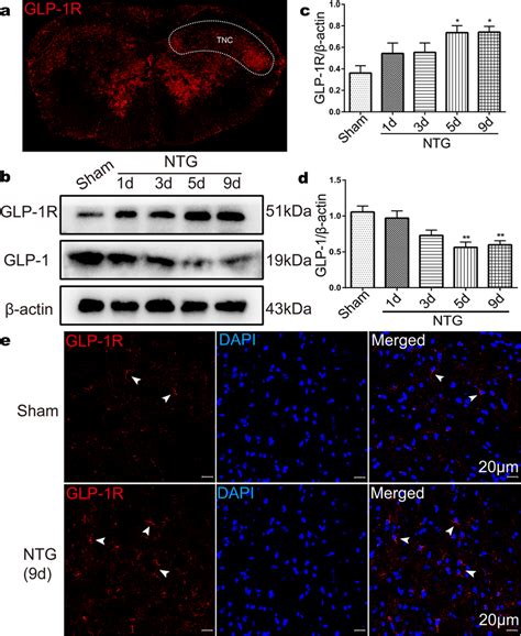 Recurrent Ntg Injection Increased Glp R Expression In The Tnc A The