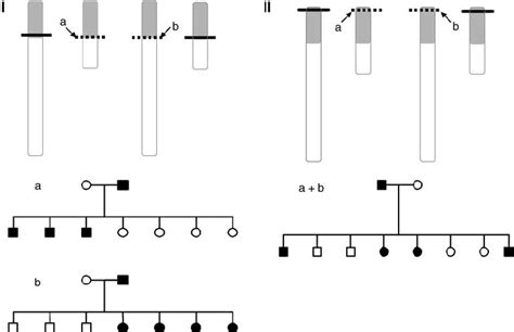 Pseudoautosomal Segregation For A Dominant Disease Depending On The