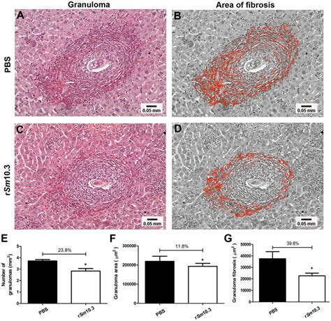 Histological Analysis Of Hepatic Tissue From Mice Vaccinated With Download Scientific Diagram