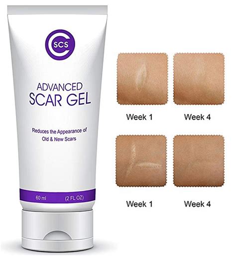 Cscs Advanced Scar Gel Reduces Appearances Of Old And New Scarring