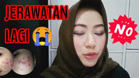 kondisi kulit   des  youtube